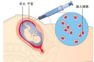 胎膜早破和破水的区别有什么