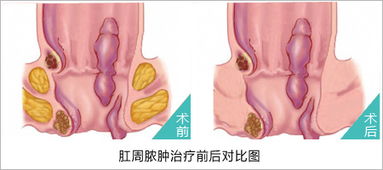 做hpv检查后要禁忌什么