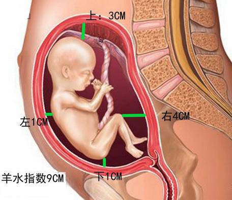 羊水指数多少算正常