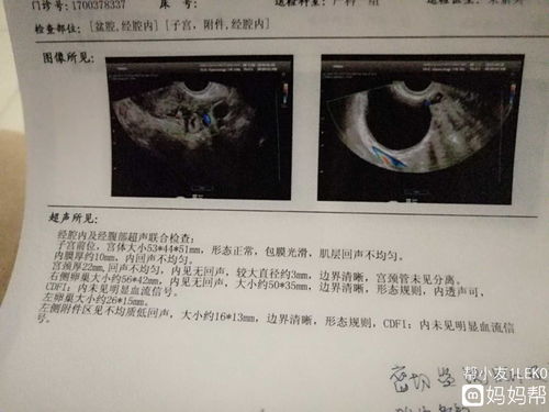 怀孕8周，彩超宫内宫外都没孕囊，怎么回事