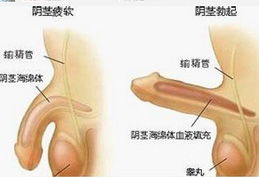 男性性功能障碍有哪些表现