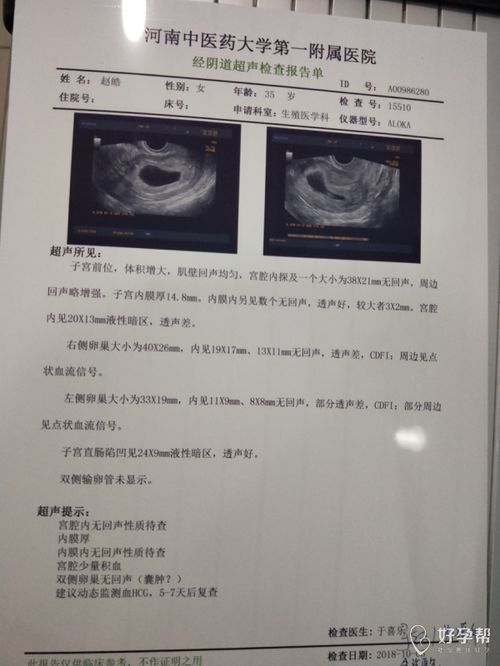 怀空囊是怎么造成的