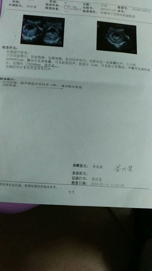 b超孕囊旁边有液性暗区是怎么回事