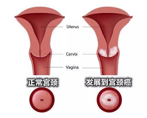 宫颈检查后多久能同房吗