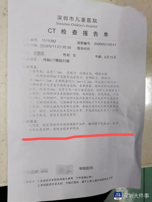 宫颈分泌物检查报告单怎么看