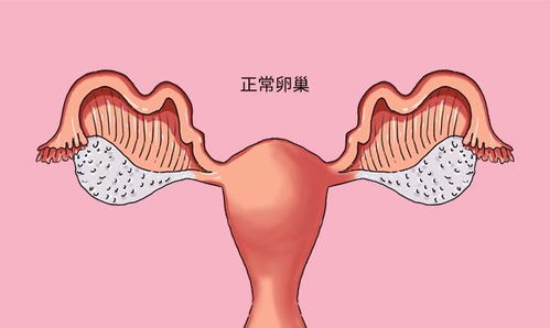 卵巢怎样才是好的