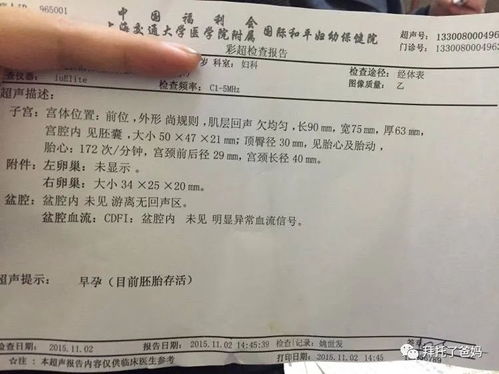 一般产检要多少钱