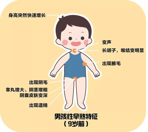 儿童性早熟是什么病