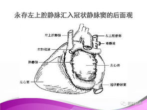 胎儿永存左上腔静脉是什么意思会消失嘛