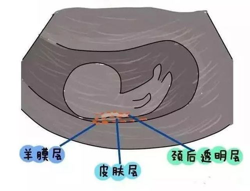 怀孕12周多做ntb超的胎心率是140多，17周多做系统b超胎心率130，怎么越来越低呀！这正常吗