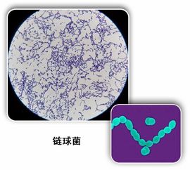 孕妇b族链球菌检测是什么意思阴性