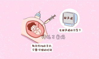 双胎可以做羊水穿刺吗多少钱