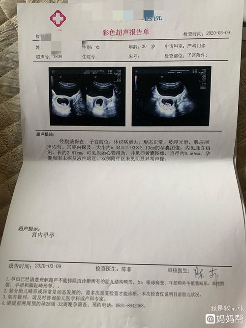 什么时候做第一次b超检查较好呢