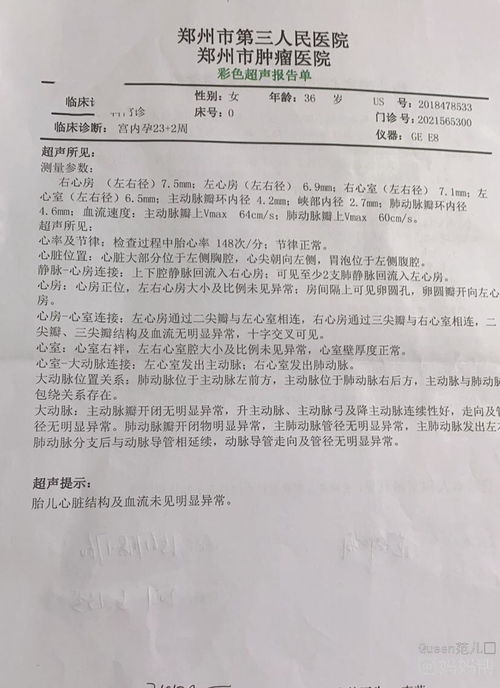 做了大排畸，需要单独做胎儿心脏b超吗