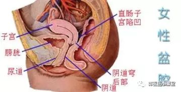 盆腔结核和盆腔炎的区别