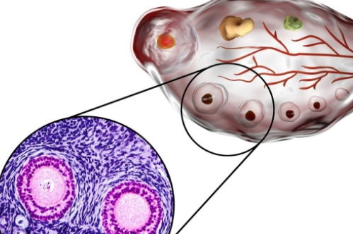 卵泡发育不良影响受孕怎么办