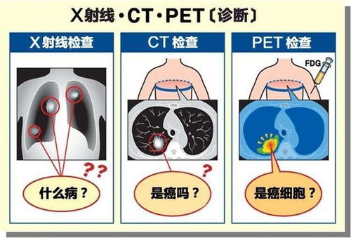 做个全身CT大概要多少钱？