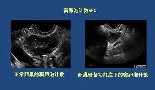 卵泡长到1.5cm长到多大才可排卵需要几天