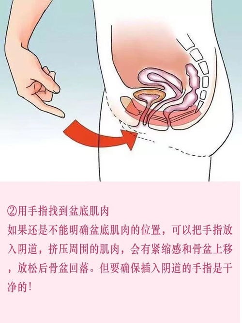 怀孕期间可以做盆底肌康复吗