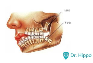 怀孕前智齿一定要拔掉吗