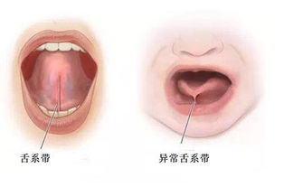 小孩出生后心脏有个洞