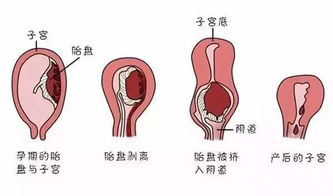 气管炎吃什么食物好?