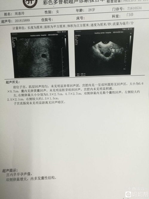 着床晚也看不到卵黄囊吗