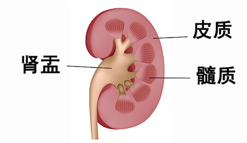 肾盂分离的后果是什么?