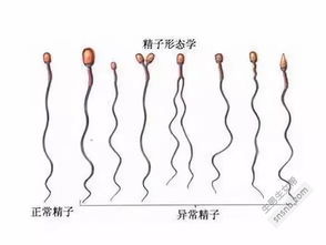 弱精症可以怀孕吗几率有多高