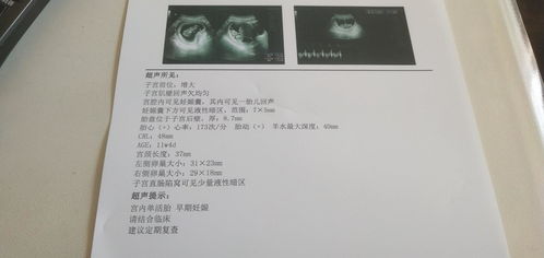 孕囊与实际停经天数不符，是因为个人身体原因吗