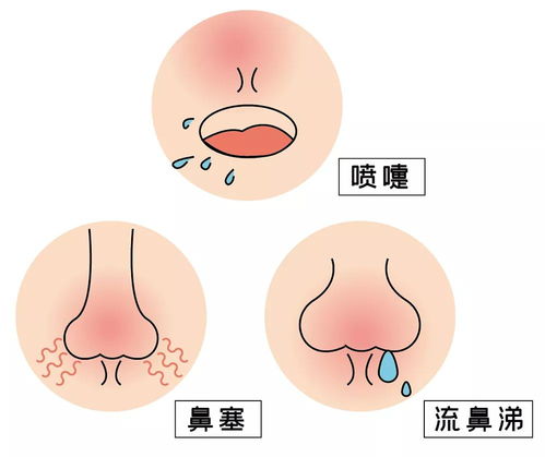 郑州看鼻炎的医院？郑州哪家鼻炎医院好？