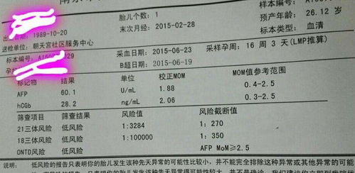 16周做唐筛需要空腹吗