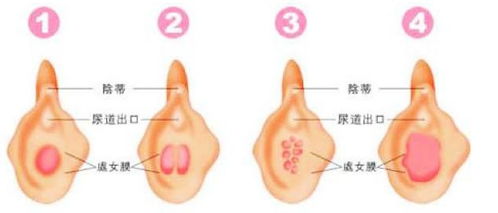 做处修手术成功率怎么样