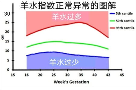 羊水深度标准对照表