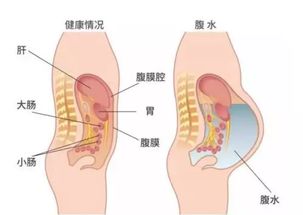 说明肚中怀的是双胞胎吗