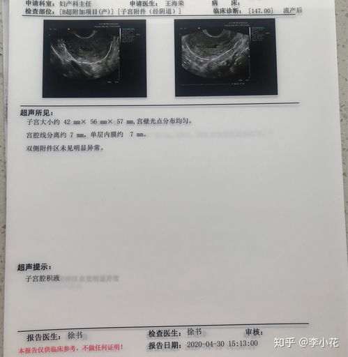 宫颈糜烂三度的危害性