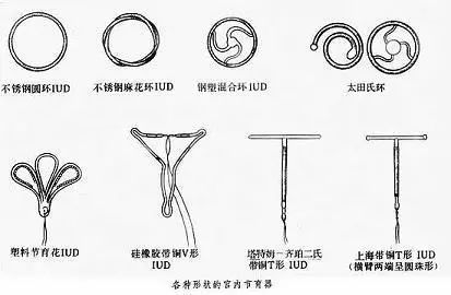 宫内节育器都有哪几种？