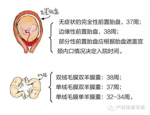 预产期主要的计算方法有哪些呢