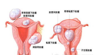 影响受精卵着床的因素有哪些