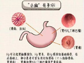 益生菌的功效与作用，哪个牌子好