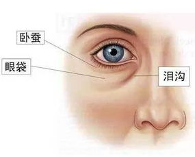 3种孕妇需特别注意眼睛症状吗