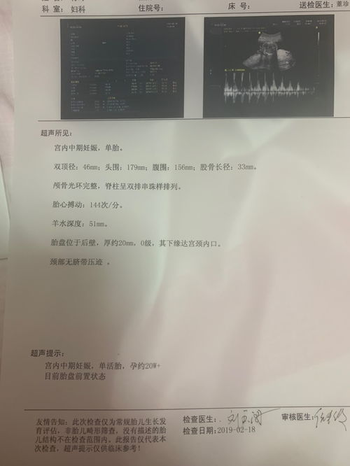 双顶径90mm宝宝有多重