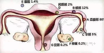 黄体期出血是什么原因以前没有过