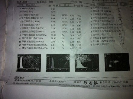 促卵泡生成素高怎么办？