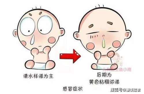 孕期过敏性鼻炎会影响宝宝吗视频