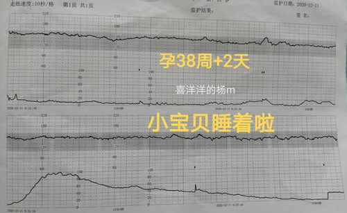 23周胎儿生长指标正常吗？