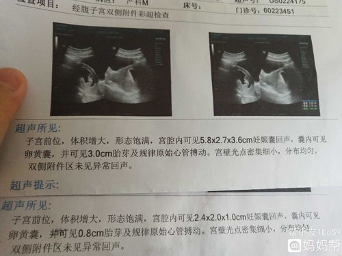 孕期间同房后出血了应该怎么办呢