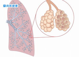 治慢性支气管炎的偏方