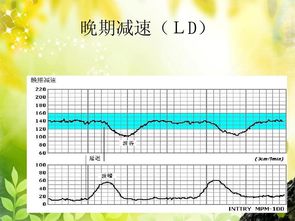 什么是胎心监护带