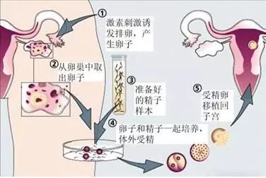 胚胎染色体正常也会胎停吗？